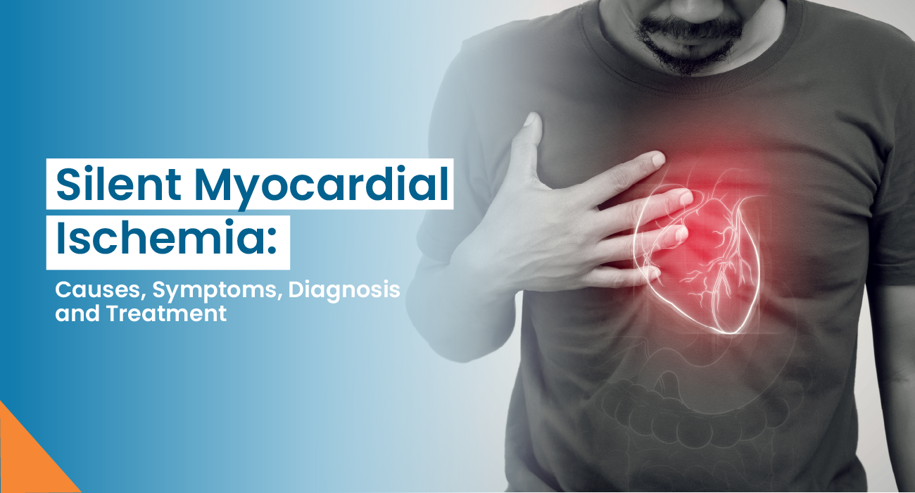Silent Myocardial Ischemia: Causes, Symptoms, Diagnosis, and Treatment